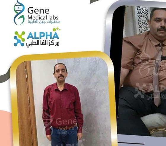 قصة حسين — من 162kg إلى 87kg